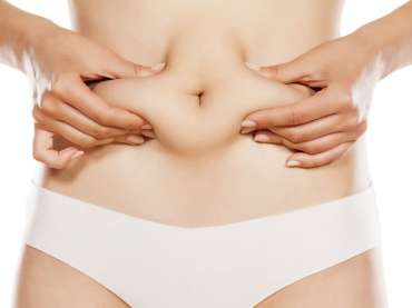 Tummy Tuck: Un paso más cerca a la perfección